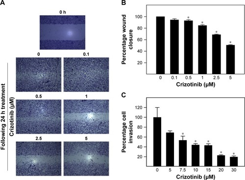 Figure 6 Effect of crizotinib treatment on migration and invasion of breast cancer cells.