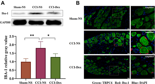 Figure 4 DRG microglia proliferation was inhibited by dexmedetomidine administration. (A) Western blot analysis showed that the CCI-induced increase in Iba-1 expression can be partially reversed by Dex administration. (B) Different columns represent the sham-NS, CCI-NS, and CCI-Dex groups. TRPC6 is labeled green, Iba-1 red, and nuclei are counterstained with DAPI (blue). The first column shows the increase in the expression of Iba-1 in the CCI-NS group. Scale bar = 20 μm. Abundant peripheral immune cells were observed around the neurons of the CCI-NS group, and the number of participating cells was markedly reduced after Dex therapy. Scale bar = 10 μm. *p < 0.05, **p < 0.01. n = 4–6.