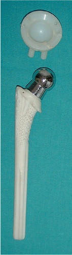 Figure 1 The acetabular and femoral components of the third-generation iso-elastic RM total hip replacement.