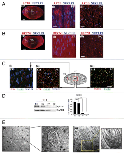 Figure 2. Active autophagy is involved in the removal of nuclei and organelles from the lens fiber cells in the E15 chick lens. (A and B) E15 lens cryosections were immunostained for the autophagy markers LC3B (A, red) and BECN1/Beclin 1 (B, red) and colabeled with the nuclear dye TO-PRO-3 (blue). Images were acquired by confocal microscopy. Images shown in the left panel of (A and B) are low magnification images represented as projections of acquired z-stacks; scale bar, 200 μm. Boxed areas are shown at higher magnification to the right, each a 1-μm optical slice selected from an acquired z-stack; scale bar, 20 μm. The cortical lens fiber cell region (FP) is designated as (i) and the central lens fiber cell region (FC) as (ii), diagrammed in the model in (C). The results show that the intensity and staining pattern of autophagy markers LC3B and BECN1 in the E15 lens is differentiation-state specific, with a vesicular appearance in the FC zone. (C) Cryosections of E15 lenses were co-immunostained either for (i and ii) LC3B (red), CALR3 (ER marker, green), and TO-PRO-3 (nuclear dye, blue) or for (iii) BECN1 (red) and CALR3 (ER marker, green) and imaged in the (i) FP and (ii) FC zones. Boxed (red), regions on the model designate areas from where images were acquired. Images are each a 1-μm optical slice selected from an acquired z-stack; scale bar, 20 μm. Confocal images are representative of 3 independent studies. In the FC zone, both LC3B and BECN1, which localize to autophagic vesicles, showed significant overlap with the ER marker CALR3, suggesting the removal of organelles during lens development occurs through an autophagic process. See also Figures S2–S4. (D) Immunoblot studies showing expression levels of SQSTM1/p62 in differentiation-specific fractions isolated by microdissection from E15 lenses. EC, undifferentiated lens epithelial cells; EQ, equatorial epithelium, the zone of differentiation initiation; FP, cortical fiber cells, a region of lens morphogenesis; and FC, central fiber cells, the region of fiber cell maturation. Quantification of SQSTM1 expression relative to GAPDH is shown in the panel on the right. Data represent 3 independent studies. This result supported the conclusion that autophagy is occurring in lens fiber cells as the loss of SQSTM1 is correlated with active autophagy. Error bars represent S.E., **P ≤ 0.01, t test. n.s., nonsignificant. See Figure S5 for immunolocalization of SQSTM1 at E15. (E, i and ii) Electron micrographs showing double-membrane-bound autophagosomes surrounding a degrading organelle that is likely a mitochondria and cytoplasmic debris in the cortical fiber cell zone close to the region of organelle loss. Boxed insets in (i and ii) are shown at higher magnification to the right. Data show structural evidence of autophagy in the region in which organelles are lost during lens development; scale bar, 500 nm. Results are representative of 4 independent studies.