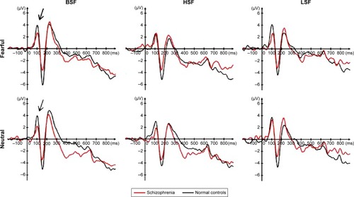 Figure 1 Averaged P100 waves at O1 and O2 electrodes in patients with schizophrenia and healthy controls. The arrows indicate ERP waves showing significant differences between schizophrenia patients and healthy controls.
