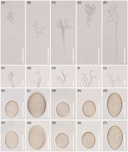 Figure 4. Morphological characteristics of five Peronospora species, P. chenopodii-ambrosioidis ex Chenopodium ambrosioides (A, F, K, P), P. chenopodii-ficifolii ex Chenopodium ficifolium (B, G, L, Q), P. clinopodii ex Clinopodium cf. vulgare (C, H, M, R), P. elsholtziae ex Elsholtzia ciliata (D, I, N, S), and P. lathyirna ex Lathyrus japonicus (E, J, O, T). (A–E), Conidiophores; (F–J), Ultimate branchlets; (K–T), Conidia (scale bars: 100 µm for conidiophores, 10 µm for ultimate branchlets, and 20 µm for conidia).