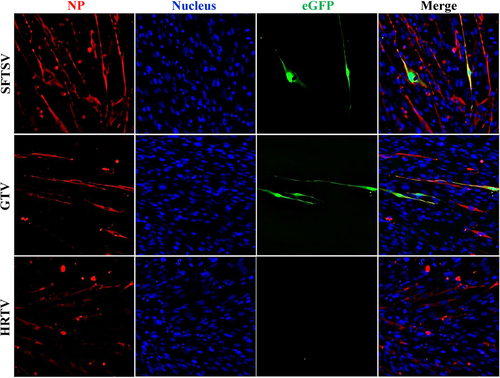 Fig. 4 Reporter assays using the SFTSV replicon system with the substitution of SFTSV, GTV, or HRTV NP, respectively.The reporter assays were performed using the egfp reporter plasmid system. NP expression in each test was immunostained with α-SNP or an HA tag. Cell nuclei were stained with Hoechst 33258. The eGFP expression was visualized under an inverted fluorescence microscope