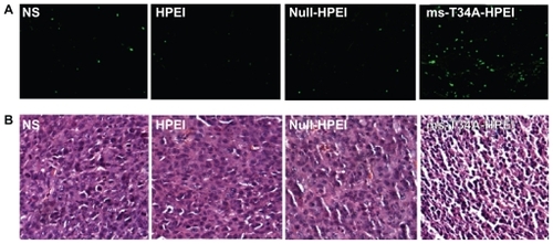 Figure 4 Detection of apoptotic tumor cells. (A) TUNEL assay (green fluoresence indicates apoptotic cells) and (B) hematoxylin and eosin assay. ms-T34A-HPEI complexes induced a significant nuclear condensation, implying induction of apoptosis.Abbreviations: HPEI, heparin-polyethyleneimine; ms-T34A, mouse survivin-T34A; NS, normal saline.
