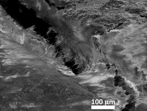 Figure 8. An SEM image revealing the filling of the marginal gap by biological masses in sample a after 6 years in vivo aging when a zinc phosphate cement was used.