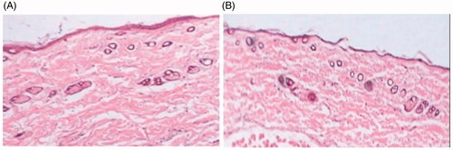 Figure 7. Histopathological microphotograph of skin treated with: (A) control (saline solution); (B) CRT loaded TTO ME (K7) hydrogel.