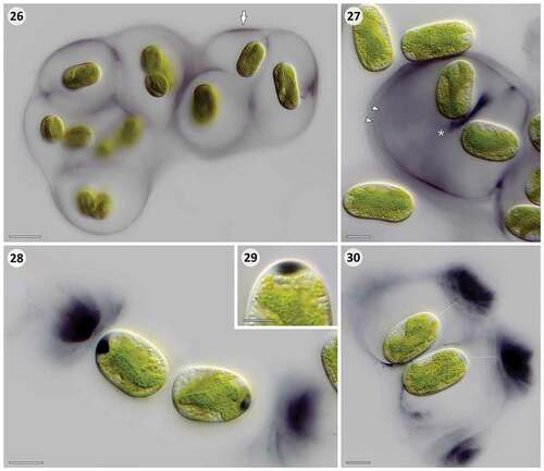 Figs 26–30. Microscopic details of extracellular pigmentation in Serritaenia species induced under setting 3 for 14 days. Fig. 26. Colony of S. testaceovaginata (strain GSM.5.thin) with pigmentation in outermost layer of the mucilaginous capsules (arrow). Fig. 27. Cells of Serritaenia sp. (strain OBE.1) exhibiting several pigment layers (arrowheads) and a pigment accumulation between recently divided cells (asterisk). Fig. 28. Dark, polar inclusions in the cells of Serritaenia sp. (strain OBE.1) associated with zones of intensely pigmented mucilage. Fig. 29. Detail of lens-like pigment inclusion at the cell pole of Serritaenia sp. (strain OBE.1). Fig. 30. Two cells of Serritaenia sp. (strain OBE.1) surrounded by mucilaginous capsules with intensely pigmented zones. The assumed trajectory of secretion is indicated by dashed lines. Scale bars: Fig. 26, 20 µm; Figs 27, 28, 30, 10 µm; Fig. 29, 5 µm.