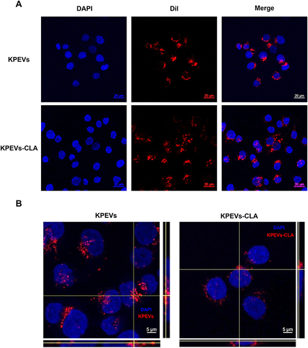 Figure 2 Confocal microscopy images of KPEVs and KPEVs-CLA localization in human gastric cells (A). AGS cells were co-cultured with Dil-labeled KPEVs or Dil-labeled KPEVs-CLA for 12 h. The cell nuclei were stained with DAPI (blue). The scale bar indicates 20 µm. (B) Ortho view of confocal microscope z-stack images of KPEVs localization in AGS human gastric cells. AGS cells were co-cultured with Dil-labeled KPEVs (red) for 12 h. The cell nuclei were stained with DAPI (blue). The scale bar indicates 5 µm.