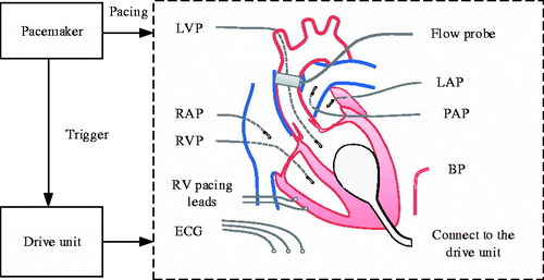 Figure 1. Schematic of a typical intra-ventricular assist device.