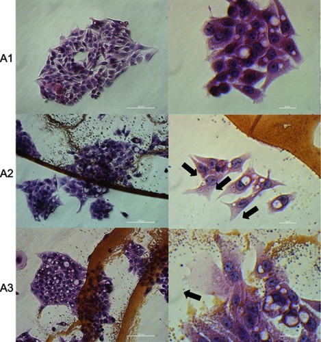 Figure 6 Morphology changes and affinity of C3A cells to the C60 nanofilms.Notes: Hematoxylin-eosin staining of C3A cells on C60 nanofilms visualized using light optical microscopy. (A1) Control group; (A2) C60-20%; and (A3) C60-100%. Black arrows indicate the direction of cell migration. Scale bars: left pictures 100 μm, right pictures 20 μm.Abbreviation: C60, fullerenes.