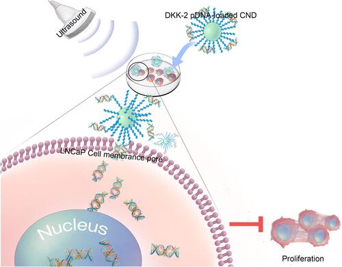 Figure 7 Schematic depiction of ultrasound-assisted DKK-2 gene delivery into LNCaP cells.