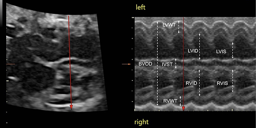 Figure 3 STIC-M measurement of fetal heart.