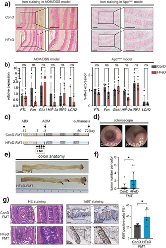 Figure 2. Microbiota modulated by excessive dietary iron increases colorectal tumorigenicity in mice. (a) Representative images of enhanced Perls’ staining (Scale bars, 400 μm) of small intestine sections in the ConD group and HFeD group (left, AOM/DSS model; right, Apcmin/+ model). (b) Gene expression of FTL, Fxn, Glut1, HIF −2a, IRP2, and LCN2 in ConD and HFeD mice (left, AOM/DSS model; right, Apcmin/+ model). (c) Schematic overview of the AOM/DSS-induced cancer model. Mice were treated with an antibiotics cocktail for five days and later underwent washed fecal microbiota transformation for four consecutive days. AOM (10 mg/kg) was injected intraperitoneally at day 0. Mice were sacrificed at the end of week 10 (ConD group, n = 12; HFeD group, n = 12). (d – e) Representative images of colonoscope and colon when sacrificed. (f) Tumor number in ConD and HFeD mice. (g) Representative images of H&E staining and Ki67-positive cells of colon sections in the ConD-FMT group and HFeD-FMT group (Scale bars, 400 μm). Quantitation of Ki67 expression in the colons (right). Data are expressed as the mean ± SD. Each data point represents one mouse. Statistical significance was determined by unpaired Student’s t-test and multiple unpaired Student’s t-test. *p < .05.