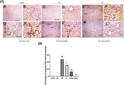 Figure 12 Hepatoprotective effect of Ganoderma lucidum on expression of caspase-3 in rat livers. (1) Representative microscopic pictures of liver sections immunostained using caspase-3 antibody showing negative staining in the control group (A and B) and GL group (C and D), while a strong positive staining as indicated by intense bright brown color in group received cisplatin (E and F). GLM treatment triggers moderate positive staining in i.p group (G and H), mild positive staining in the EOD group (I and J), and negative staining in the daily group (K and L). Black arrows point to positive staining. IHC counterstained with Mayer’s hematoxylin. X: 100 bar 100 (A, C, E, G, and I) and X: 400 bar 50 (B, D, F, H, and J). (2) Statistical analysis of IHC staining intensity percentages in six experimental groups showing a significant increase in caspase-3 in CP group when compared with control and GL groups, and the protective effect of GLM in different treated groups. Different small alphabetical letters means significant when P< 0.05. aSignificant against control group; bsignificant against GL group; csignificant against CP group; dsignificant against i.p. group. (A) Ganoderic acid A binding with HMGB-1 (2D- and 3D-binding modes). (B) Ganoderic acid B binding with HMGB-1 (2D- and 3D-binding modes). (C) Ganoderic acid C6 binding with HMGB-1 (2D- and 3D-binding modes). (D) Ganoderic acid D binding with HMGB-1 (2D- and 3D-binding modes). (E) Ganoderic acid G binding with HMGB-1 (2D- and 3D-binding modes). (F) Ganoderic acid J binding with HMGB-1 (2D- and 3D-binding modes).