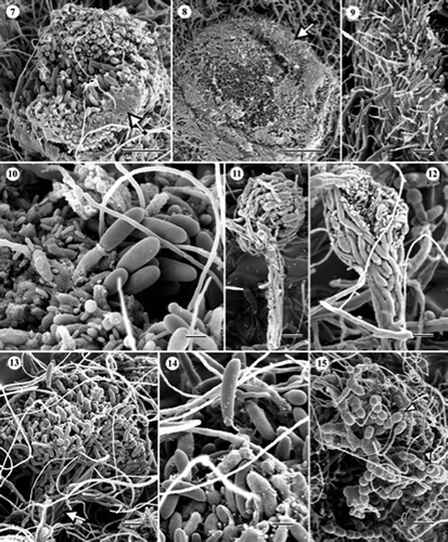 Figures 7–15. Scanning electron micrographs (SEM) of Cryptosporiopsis radicicola (ex-type, UAMH 10729, CBS 640.94) on MEA after 1 month at 22 °C. (7) Conidioma with an opening excipular covering tissue (arrow). (8) Mature conidioma. (9) Enlarged view of excipular tissue consisting of thicker hyphal and finer setose elements, partially embedded in adhesive amorphous material. (10) Part of conidiogenous layer showing abundant macro- and micro-conidia, and sparse setose hyphae. Conidiogenous cells are embedded in amorphous material. Figures 11–15. SEM of C. ericae (BWC-43-127a, UAMH 10920) on MEA after 1 month at 22 °C. (11) Developing synnema. (12) Synnema forming numerous macro- and micro-conidia. (13) Sporodochium-like structure resulting from the merger of two synnemata. The arrow indicates the thickened stipe. (14) Enlarged view of a portion of a conidial head showing macro- and micro-conidia, and sparse setose hyphae. (15) Chains of chlamydospores. Septum schizolysis was infrequent (arrowheads). Bars = 20 μm (Figure 7); 40 μm (Figure 8); 10 μm (Figures 9, 12 and 14); 5 μm (Figure 10); 15 μm (Figures 11 and 13); 33 μm (Figure 15).