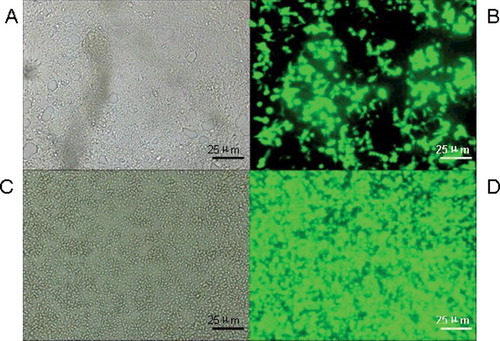 Figure 4. pAd-Cav3.3 shRNA adenovirus infection efficiency in DRG cells: 24 h (A) and 48 h (B) after infection with pAd-Cav3.3 shRNA adenovirus and after amplification (C,D).