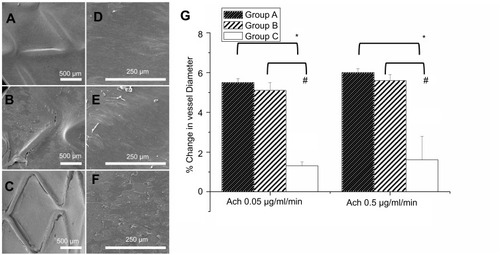 Figure 3 Evaluation of the coverage and morphology of endothelium and in vivo endothelial function after 3 weeks of stenting treatment was evaluated from variation in abdominal aorta diameter using different acetylcholine dose infusions. The coverage of endothelium on struts in three groups at 8 weeks at different magnifications (35×: a, b, and c with scale bar: 500 μm; 200×: d, e, and f with scale bar: 250 μm). (A) Group A had full coverage. (B) Almost full coverage was noted on stent struts in group B. (C) The region in which stents were deployed was poorly covered in group C. (D and E) Endothelial cells in groups A and B were aligned parallel to the flow direction with regularly shaped endothelial cells among each other by close contact. (F) Endothelial alignment of stenting vessels in group B was more weakly in flow direction. Extended and uneven intercellular spaces, irregular size of endothelial cells, and poorly aligned surface were shown in group C. (G) Significantly greater responses in vildagliptin-eluting stent than that in non-drug-eluting stent were observed according to endothelial-dependent vasodilatory reaction to Ach. (*p<0.05 group A versus group C; # p<0.05 group B versus group C).