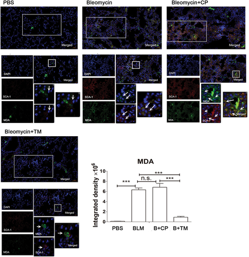 Figure 4. The Tocilizumab mimotopes reduced lipid peroxidation product in the whole lung tissues the tissue sections were incubated with anti-sca-1 and anti-MDA antibody and followed by Alexa Fluor 488 and 594-conjugated secondary antibody. Representative images were captured with a microscope (×200–400 magnification, presented bar: 50–20 μm). Each image of immunofluorescence was acquired at the same adjustment parameters. Red (SCA-1): black (10.0) gamma (0.6) white (80.0). Green (MDA): black (25.0) gamma (0.2) white (200.0). The results showed that immunization with the Tocilizumab mimotopes could reduce the expression of MDA in the whole lung tissue, including the fibroblasts. (Representative image, n = 6 mice per group. Mean ± SEM; ***p < .001; **p < .005; *p < .05; n.s. non-significant; Representative image, n = 6 mice per group).