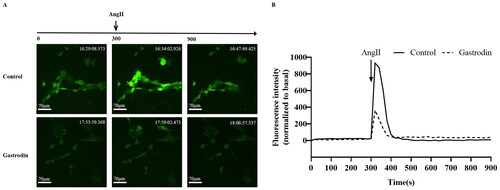 Figure 6. The effects of gastrodin on release of intracellular calcium in Ang II-stimulated vascular smooth muscle cells (VSMCs). Confocal microscopy was performed to measure changes in intracellular Ca2+ concentration in real time. (A) Representative images of intracellular calcium release in VSMCs at different time points. Images were taken at a magnification of ×200. (B) A graph of the change in intracellular Ca2+ concentration is shown.