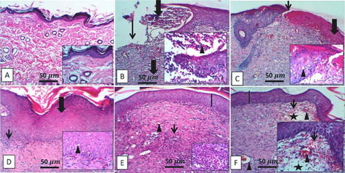 Figure 2. Representative photomicrograph of skin from different treatment groups. A: Control skins show a normal histological appearance of the epidermis and dermis in low-power and inset images. B: Skins of the diabetic group show extensive ulceration with numerous neutrophilic infiltrations and scanty granulation tissue (thick arrow), inset, adjacent epidermis showing marked neutrophilic aggregates (arrowhead) invading and surrounding the hyperplastic epithelium. C: the diabetic group shows cellular crust (thick arrow), and the dermal layers show hemorrhage admixed with a mild number of cellular infiltrates (thin arrow), inset, the adjacent epithelium is hyperplastic with acanthosis and spongiosis (arrowhead). D: the diabetic + ZW group typically arranged complete epidermal layers (line) with dermal ectatic blood capillary (arrowhead) and few inflammatory cells, focal edema (star), and dense granulation tissue. E: the diabetes + dapagliflozin group showed a complete epidermis with extensive epidermal hyperplasia (thick arrow) with thickened dermal collagen deposition and diminished blood vessels (thin arrow), inset, the hyperplastic epidermal cells showed few vacuolar degenerations (arrowhead). F: the diabetic + ZW + dapagliflozin group shows mild epidermal thickening (line) with fibroblast proliferation, collagen deposition, and enhanced newly vascular formation, inset, fibroblast infiltrations, and increased blood vessels. Image magnification = 400X, bar = 50 µm.