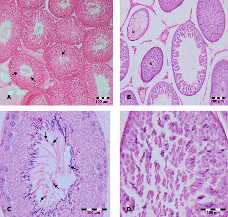 Figure 2. Photomicrographs of testis sections of DZN-treated animals, (A) in 2 weeks of DZN exposure (15 and 30 mg/kg b.w.), treated animals showed disorganization and disintegration of cell, which caused secondary spermatocyte (arrows) moved into lumen (100×), (B) shrinkage (*) of seminiferous tubules and loss of cells (lc), (C) more immature cells appeared in the lumen of 30 mg/kg b.w. DZN-treated animals (arrows), and (D) abnormal formation of spermatozoa in the lumen. Slides were stained with haematoxylin-eosin dye. Scale of (A) and (B) – 200 µm, (C) and (D) – 100 µm.