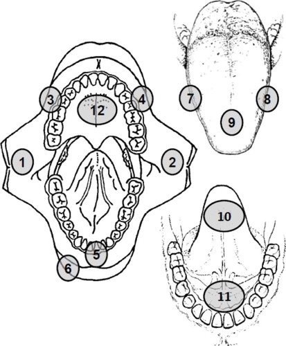 Figure 1 Schematic diagram showing the anatomical sites where electrical impedance spectroscopy measurements were made in the normal subjects. (1) Right buccal mucosa, (2) left buccal mucosa, (3) right gingiva, (4) left gingiva, (5) labial mucosa, (6) vermillion, (7) right lateral tongue, (8) left lateral tongue, (9) dorsum of tongue, (10) ventral tongue, (11) floor of mouth, and (12) hard palate.