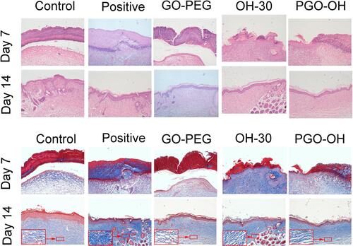 Figure 9 Skin samples were prepared on days 7 and 14 after mice were treated with GO-PEG, OH30, or PGO-OH30. Then, H&E and Masson staining were performed to analyze pathological changes in the skin.