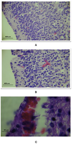 Figure 2. The general histological changes of the cerebral blood vessels in the three study groups as compared to the control group (using Eosin and Haematoxylin stain). A: the control group exhibited normal histology of the capillary blood vessel (20X magnification), B: in study group A, there was a dilation of the capillary vessel in the cerebral cortex, as indicated by the arrow (20X magnification), C: in study group C, a ruptured blood vessel in the cerebral cortex was observed, with red blood cells (RBCs) escaping into the cortex (100X magnification).