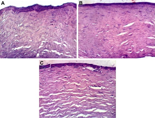 Figure 9 Histopathologic evaluation of the rabbit corneas after instillation of normal saline solution (A), OIG (B) and L3 (C) formulations.Abbreviations: OIG, optimized in situ gel; L3, selected lyophilized formula.