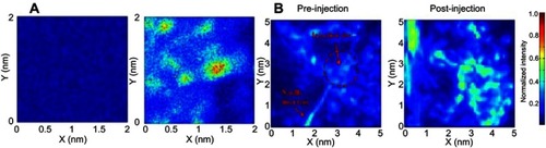 Figure 11 Capability of NR@SA nanoplatform for PA imaging. (A) 2 × 2 mm area of projected C-scan PA images of nontreated and NR@SA treated tramp C1 tumor cells. (B) in vivo photoacoustic imaging from tumor-bearing mice during and after local delivery of NR@SA. Reprinted with permission from Chiu HT, Chen CH, Li ML, et al. Bioprosthesis of core-shell gold nanorod/serum albumin nanoimitation: a half-native and half-artificial nanohybrid for cancer theranostics. Chem Mater. 2018;30:729–747.Citation138 Copyright (2018) American Chemical Society.