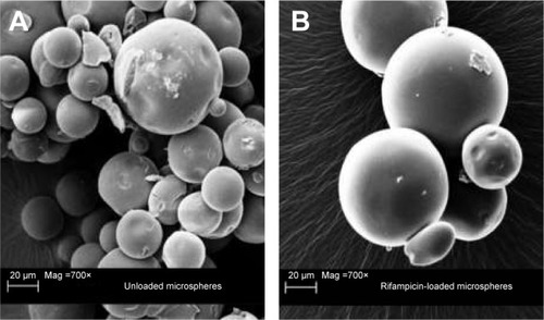 Figure 1 Scanning electron microscope image of the different microspheres.