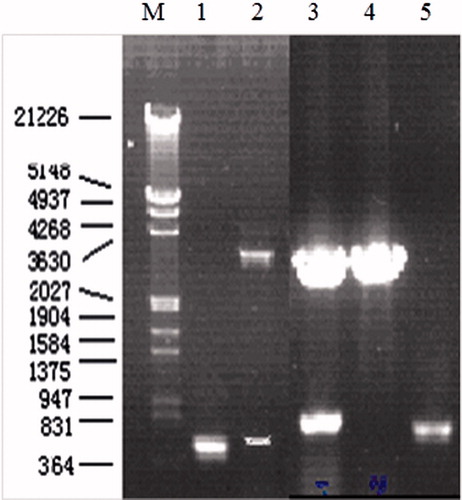 Figure 1. PCR amplification of SEG and SEI gene and verification of positive clone with pGEM-T-SEG and pGEM-T-SEI by double RE digestion. M: DNA marker; 1: PCR product of SEI; 2: result of double RE digestion of positive clone with pGEM-T-SEI; 3: result of double RE digestion of positive clone with pGEM-T-SEG. 4: result of double RE digestion of negative clone with pGEM-T-SEG; 5: PCR products of SEG.
