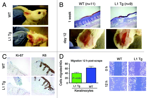 Figure 5. Wound-healing defects in adult L1 Tg animals and migratory deficiency in L1 keratinocytes (A) Representative ear images of a WT mouse and a L1 Tg mouse (both ~6-mo-old). (B) Wound-healing defects in 3-mo-old L1 Tg. Shown on top are representative H and E images (×40) depicting that the WT epidermis completely re-epithelialized and closed the wound 1 wk after injury, whereas the L1 Tg epidermis showed disorganized and incompletely healed wound. Shown at the bottom are gross images of wounds in WT and Tg animals 12 d post epidermal abrasion. Note incomplete wound closure in the L1 Tg epidermis. The H and E and gross images shown are representative of a total 11 (for WT) and 9 (for L1 Tg) animals analyzed. (C) IHC staining for Ki-67 and K6 as short-term markers of proliferation and differentiation, respectively. Shown are images 48 h after wounding. Original magnifications, ×100. (D) Graph depicting the number of cells that migrated into scrape wound area 12 h post-scrap (left) and microscopic images of newborn keratinocyte cultures at 0 and 12 h post-scrape (right).