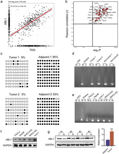 Figure 5. Aberrant DNA hypermethylation of ABL1 and aberrant expression of ABL1 in HCC. (a, b) Correlation analysis between TDG and ABL1. (c) Bisulfite sequencing analysis of ABL1 promoter methylation in randomly detected in HCC samples. (d) the methylation status of ABL1 was randomly detected in HCC. (e) the methylation status of ABL1 was detected in HCC cell lines. (f) ABL1 protein expression in HCC. (g) ABL1 protein expression in HCC cell lines. *P<.01. Black dots, methylated; white dots, unmethylated.