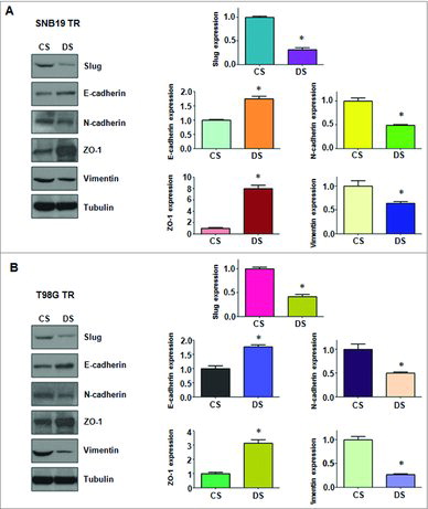 Figure 6. Depletion of CDC20 regulated protein levels of EMT markers in TMZ-resistant cells. A. Left panel: Western blotting analysis was used to detect the expression of EMT markers in SNB19/TR cells after CDC20 depletion. Right panel: Quantitative results are illustrated for left panel. * P<0.05 vs control. B. Left panel: Western blotting analysis was performed to measure the expression of EMT markers in T98G/TR cells after CDC20 depletion. Right Panel: Quantitative results are illustrated for left panel. * P<0.05 vs control.