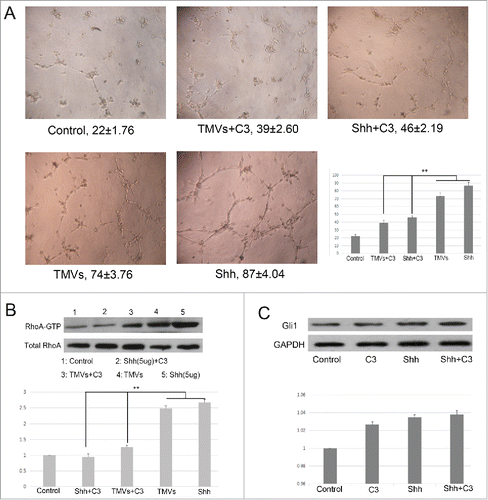 Figure 5. The efficacy of Shh/RhoA pathway on tube formation of HUVECs in vitro. A, Phase-contrast micrographs showed that MVs harboring Shh enhanced network formation of HUVECs on Matrigel. The efficacy of MVs-enhanced network formation was inhibited by C3 transferase (5 ug/ml). The Shh (5 ug/ml) was used as the positive control. The treatment condition and the actual number of branch points ± SEM were underneath the image. Branch points were used to quantify angiogenesis; B, Shh associated tube formation was related with RhoA activation; C, the expression of Gli1 in HUVECs after rh-shh (5 ug/ml) treatment. A difference of P < 0.05 was considered significant.
