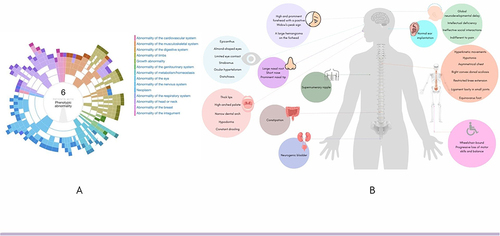 Figure 2 Phenogram of patients harboring sequence variants in SYT1 (12q21.2). (A) abnormalities by ontological clustering in open access DECIPHER patients;Citation13 (B) Synopsis of phenotype of a male patient diagnosed with Baker-Gordon Syndrome from Central Brazil.