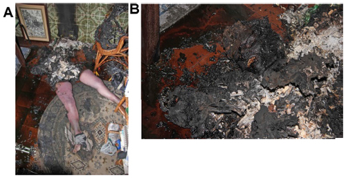 Figure 1 General findings at the scene.