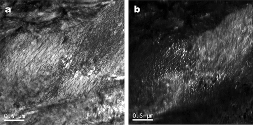 Figure 24. Bright field (left) and corresponding dark field image (right) of medium-carbon steel quenched to 100°C for 20 s and partitioned at 350°C for 10–30 s. Dark field images were taken using 020 ε-carbide reflection (adapted from reference [Citation45]).