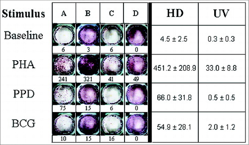 Figure 1. IFN-γ production in primary mononuclear cell cultures challenged with Phytohaemaglutinin (PHA), Purified Protein Derivative (PPD) and M. bovis BCG. In the left panel, ELISPOT assay results for representative healthy adult mononuclear (A and B) and neonate cord blood cells (C and D) are shown. The corresponding production levels in terms of counts of spot forming colonies are described below. PHA, PPD and BCG antigens were used at concentrations of 1% and 5 μg/ml, respectively. In the right panel, the average productions (± SEM) for healthy adult mononuclear (HD) and neonate cord blood cells (UV) are shown.