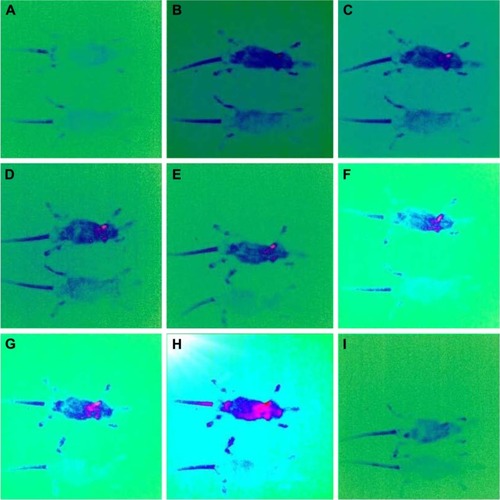 Figure 7 In vivo imaging of MS induced mice using fluorescently labeled plasmid encoding CD200 at C/P ratio 8.Notes: Mice were injected with the final volume of 100 μL of the polyplex formulation. (A) The control mice received 100 μL of HBG buffer. (B–I) Mice were injected with the polyplexes and imaging was performed at the time points of 0, 15, 30, 60, 120, 180 min and 24 h post injection. Magnification ×10.Abbreviations: C/P, carrier to plasmid ratio; MS, multiple sclerosis; HBG, HEPES buffered glucose.