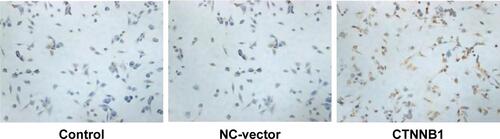 Figure S2 Intracellular distribution of β-catenin in ACHN cells after CTNNB1 overexpression. Immunohistochemistry staining was performed at 48 h after treatment with pLKO.1-EGFP-CTNNB1 vector (CTNNB1) or the negative control vector. Magnification, × 200.Abbreviation: NC, negative control.