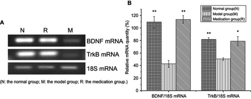 Figure 3 Effects of ginsenoside Rb1 on the changes in the expression of BDNF and TrkB mRNA induced by acute stress (n=6). (A) Representative photographs of BDNF and TrkB mRNA expression in hippocampal tissue. (B) Expression levels of BDNF and TrkB mRNA were significantly higher in the control and medication groups than in the model group. N: the normal group; M: the model group; R: the medication group. Values are represented as the mean ± SEM; *P<0.05 versus M; **P<0.01 versus M.
