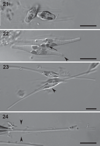 Figs 21–24. Auxospore and initial cell formation in Cylindrotheca closterium, LM. The crosses illustrated are B6 × E9 (Figs 21, 24) and E6 × Ps2 (Figs 22, 23). 21. Young auxospores starting expansion. 22. Expanding auxospores. The bands of the transverse perizonium are visible, as well as a polar cap covering one of the auxospore ends (arrowhead). One of the chloroplasts in the upper auxospore is rounded and reduced in size (arrow). 23. Full-grown auxospores. The arrowhead indicates a single nucleus lying against one side of the auxospore. 24. Initial cell with ruptured perizonium. The rupture zone is indicated by arrowheads. Scale bars = 10 µm.