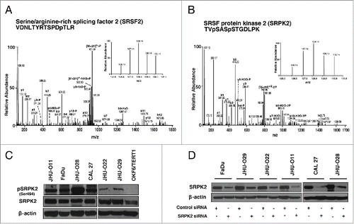 Figure 4. Representative MS and MS/MS spectra of phosphopeptides identified in HNSCC cells (A) serine/arginine-rich splicing factor 2 (SRSF2) (B) SRSF protein kinase 2 (SRPK2) (C) Western blot analysis shows overexpression and hyperphosphorylation of SRPK2 in a panel of HNSCC cell lines compared to OKF6/TERT1. (D) Western blot analysis shows a decrease in SRPK2 expression in HNSCC cell lines transfected with SRPK2 siRNA. β-actin was used as a loading control.