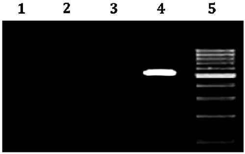 Figure 10. Agarose gel image showing successful polymerase chain reaction (PCR) amplification of 16 S rRNA Gene of H. pylori-infected male Wistar rat antrum. Lane1: Amplicon using SWFI(sterile water for injection) instead of DNA (−ve control). Lane 2: Amplicons using the DNA isolated from the gastric mucosa of infected animals treated with standard Clarithromycin +amoxicillin + Omeprazole(CAO). Lane 3: Amplicons using the DNA isolated from the gastric mucosa of infected animals treated with CCA-CPG-A beads. Lane 4: Amplicons using the DNA isolated from the gastric mucosa of control group of animals (product size 534 base pairs) (+ve control). Lane 5: DNA Ladder 100 base pair.