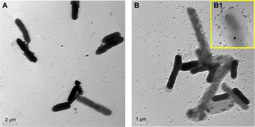 Figure 8 Transmission electron micrographs of Escherichia coli before and after treatment with GlcN-AuNPs.Notes: (A) Bacteria before treatment with GlcN-AuNPs showing clear and well structured morphology. (B) Bacteria after treatment with GlcN-AuNPs showing damaged cell membranes and ruptured structures. (B1) Inset image shows nanoparticles attached and surrounding E. coli.Abbreviations: AuNPs, gold nanoparticles; GlcN-AuNPs, glucosamine-functionalized gold nanoparticles.