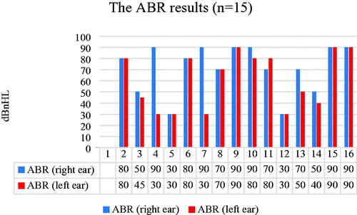 Figure 5. ABR results of the 15 children who have undergone ABR test.