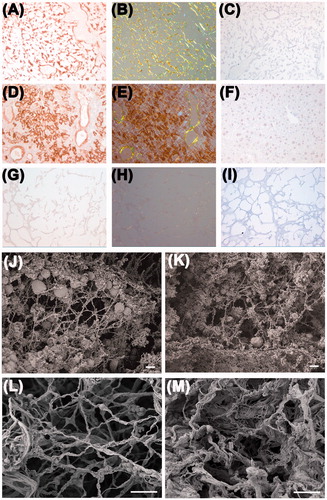 Figure 2. Amyloid in decellularized amyloidotic mouse liver. (A, B) Decellularized liver scaffold from a heavily amyloidotic mouse was stained by immunohistochemistry for SAA and with Congo red, and viewed under bright field illumination A and with crossed polarizers B respectively. (C) No primary antibody control for A. (D, E) Intact liver from an SAA expressing amyloidotic mouse stained for SAA and with Congo red and viewed under bright field, D, and crossed polarized light, E, showing amyloid in portal tracts. In addition, nascent SAA within the cytoplasm of hepatocytes gave strong immunohistochemical signal. (F) No primary antibody control for intact liver. (G, H) Decellularized healthy mouse liver did not stain with SAA antibody or Congo red viewed under bright field (G) or cross polarized light (H). (I) no primary antibody control for decellularized healthy mouse liver. (J, K) SEM images of native normal and amyloidotic livers respectively. (L, M) SEM images of decellularized healthy and amyloidotic liver, respectively. Scale bar 200 µm, A–I; 2 µm, J–K, and 10 µm, L–M.