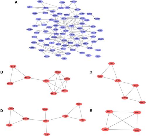 Figure 3 PPI network construction and functional module analysis. The whole PPI network (A). Network of functional module 1 (B). Network of functional module 2 (C). Network of functional module 3 (D). Network of functional module 4 (E).